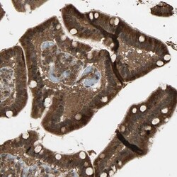 Gemin 3 Antibody, Novus Biologicals 0.1mL; Unlabeled:Antibodies, Polyclonal