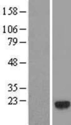 Novus Biologicals&trade;&nbsp;GEMIN6 Overexpression Lysate