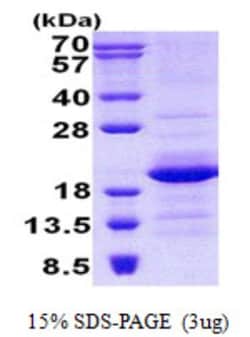 Novus Biologicals&trade;&nbsp;Recombinant Human GEMIN6 His Protein