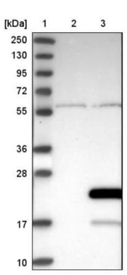 GEMIN6 Antibody, Novus Biologicals:Antibodies:Primary Antibodies