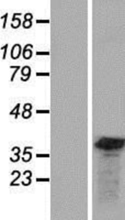 Novus Biologicals&trade;&nbsp;GEMIN8 Overexpression Lysate