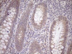 GEMIN8 Antibody (OTI1E5), Novus Biologicals 0.1mL; Unlabeled:Antibodies,