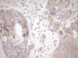 GEMIN8 Antibody (OTI1E5), Novus Biologicals 0.1mL; Unlabeled:Antibodies,
