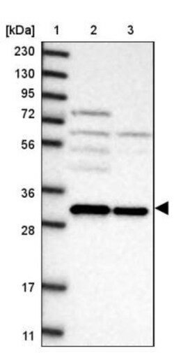 GEMIN8 Antibody, Novus Biologicals 0.1mL; Unlabeled:Antibodies, Polyclonal