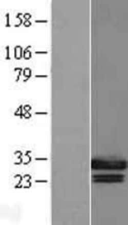 Novus Biologicals&trade;&nbsp;Geminin Overexpression Lysate
