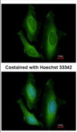 Genethonin 1 Antibody, Novus Biologicals 0.1 mL | Buy Online | Novus Biologicals | Fisher Scientific