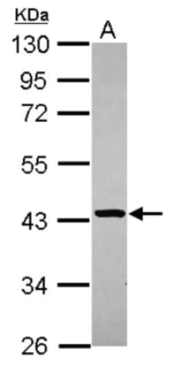 Genethonin 1 Antibody, Novus Biologicals 0.1 mL | Buy Online | Novus Biologicals | Fisher Scientific