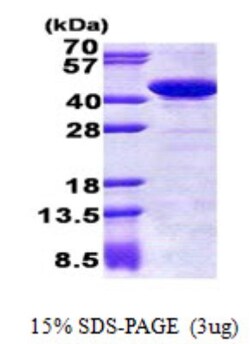 Novus Biologicals&trade;&nbsp;Recombinant Human Genethonin 1 His Protein