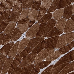 TRIM8 Antibody, Novus Biologicals 0.1mL; Unlabeled:Antibodies, Polyclonal