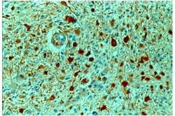 GFAP Antibody, Novus Biologicals:Antibodies:Primary Antibodies