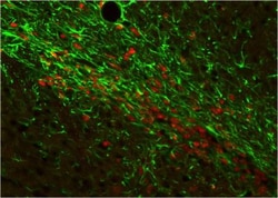 GFAP Antibody, Novus Biologicals 0.05mL | Buy Online | Novus Biologicals | Fisher Scientific