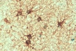 GFAP Antibody, Novus Biologicals 0.1mg; Unlabeled:Antibodies, Polyclonal