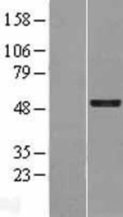 Novus Biologicals&trade;&nbsp;GFI-1 Overexpression Lysate