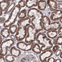 GFM1 Antibody, Novus Biologicals 0.1mL; Unlabeled:Antibodies, Polyclonal