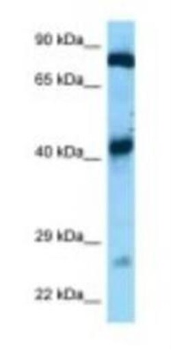GFM1 Antibody, Novus Biologicals 100 &mu;L | Buy Online | Novus Biologicals | Fisher Scientific