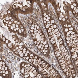 GFM2 Antibody, Novus Biologicals:Antibodies:Primary Antibodies