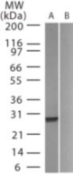 GFP Antibody, Novus Biologicals 0.1mg; Unlabeled:Antibodies, Polyclonal