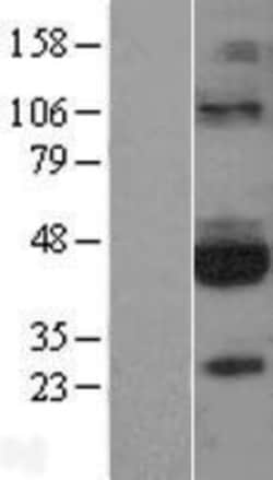 Novus Biologicals&trade;&nbsp;GFR alpha-3/GDNF R alpha-3 Overexpression Lysate