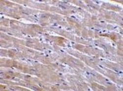 GFR alpha-3/GDNF R alpha-3 Antibody, Novus Biologicals 0.025 mg, Unconjugated:Antibodies,