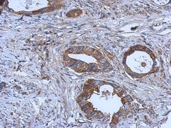 GGA1 Antibody, Novus Biologicals 0.1 mL | Buy Online | Novus Biologicals | Fisher Scientific