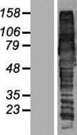 Novus Biologicals&trade;&nbsp;GGA1 Overexpression Lysate