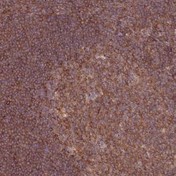 GGA1 Antibody, Novus Biologicals 0.1mL; Unlabeled:Antibodies, Polyclonal