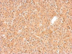 GGPS1 Antibody, Novus Biologicals 0.1mL; Unlabeled:Antibodies, Polyclonal