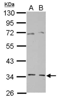 GGPS1 Antibody, Novus Biologicals 0.1mL; Unlabeled:Antibodies, Polyclonal