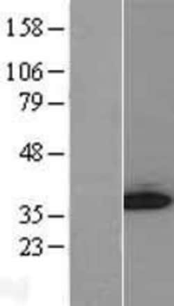 Novus Biologicals&trade;&nbsp;GGPS1 Overexpression Lysate