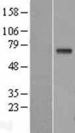 Novus Biologicals&trade;&nbsp;GGT1 Overexpression Lysate