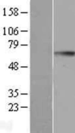 Novus Biologicals™ GGT1 Overexpression Lysate