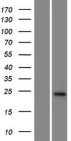 Novus Biologicals&trade;&nbsp;GGTLC1 Overexpression Lysate