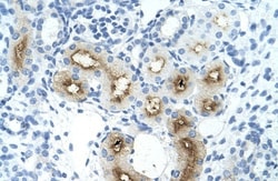 GGTLC1 Antibody, Novus Biologicals 100 &mu;L | Buy Online | Novus Biologicals | Fisher Scientific
