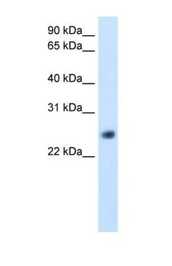 GGTLC1 Antibody, Novus Biologicals 100 &mu;L | Buy Online | Novus Biologicals | Fisher Scientific