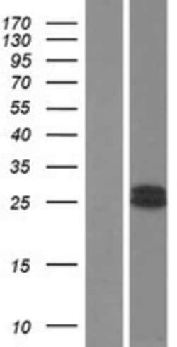 Novus Biologicals&trade;&nbsp;Growth Hormone 2 Overexpression Lysate