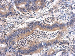 GHDC Antibody, Novus Biologicals 0.1 mL | Buy Online | Novus Biologicals | Fisher Scientific