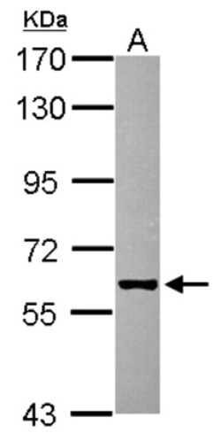 GHDC Antibody, Novus Biologicals 0.1 mL | Buy Online | Novus Biologicals | Fisher Scientific