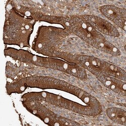 GHDC Antibody, Novus Biologicals 0.1mL; Unlabeled:Antibodies, Polyclonal
