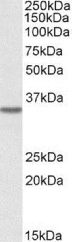 GHITM Antibody, Novus Biologicals 0.1mg; Unlabeled:Antibodies, Polyclonal