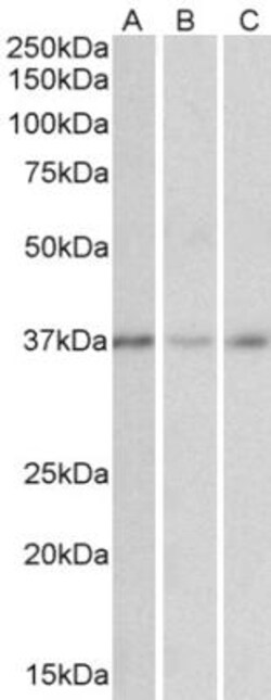 GHITM Antibody, Novus Biologicals 0.1mg; Unlabeled:Antibodies, Polyclonal