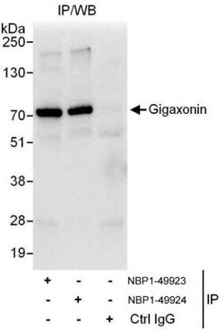 Gigaxonin Antibody, Novus Biologicals 0.1mg; Unlabeled:Antibodies, Polyclonal