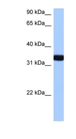GIMAP1 Antibody, Novus Biologicals:Antibodies:Primary Antibodies