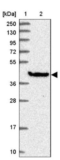 GIMAP1 Antibody, Novus Biologicals 25 &mu;L, Unconjugated:Antibodies, Polyclonal