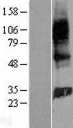 Novus Biologicals&trade;&nbsp;GIMAP2 Overexpression Lysate