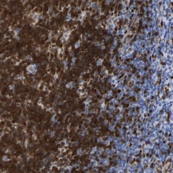 GIMAP4 Antibody, Novus Biologicals 25 &mu;L; Unlabeled:Antibodies, Polyclonal