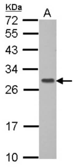 GIMAP6 Antibody, Novus Biologicals 0.1mL; Unlabeled:Antibodies, Polyclonal