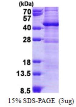 Novus Biologicals&trade;&nbsp;Recombinant Human GIMAP6 His Protein