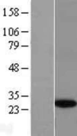 Novus Biologicals&trade;&nbsp;GINS4 Overexpression Lysate