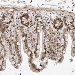GINS4 Antibody, Novus Biologicals 0.1mL; Unlabeled:Antibodies, Polyclonal