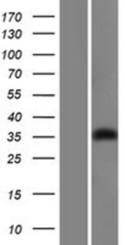 Novus Biologicals&trade;&nbsp;GIPC1 Overexpression Lysate